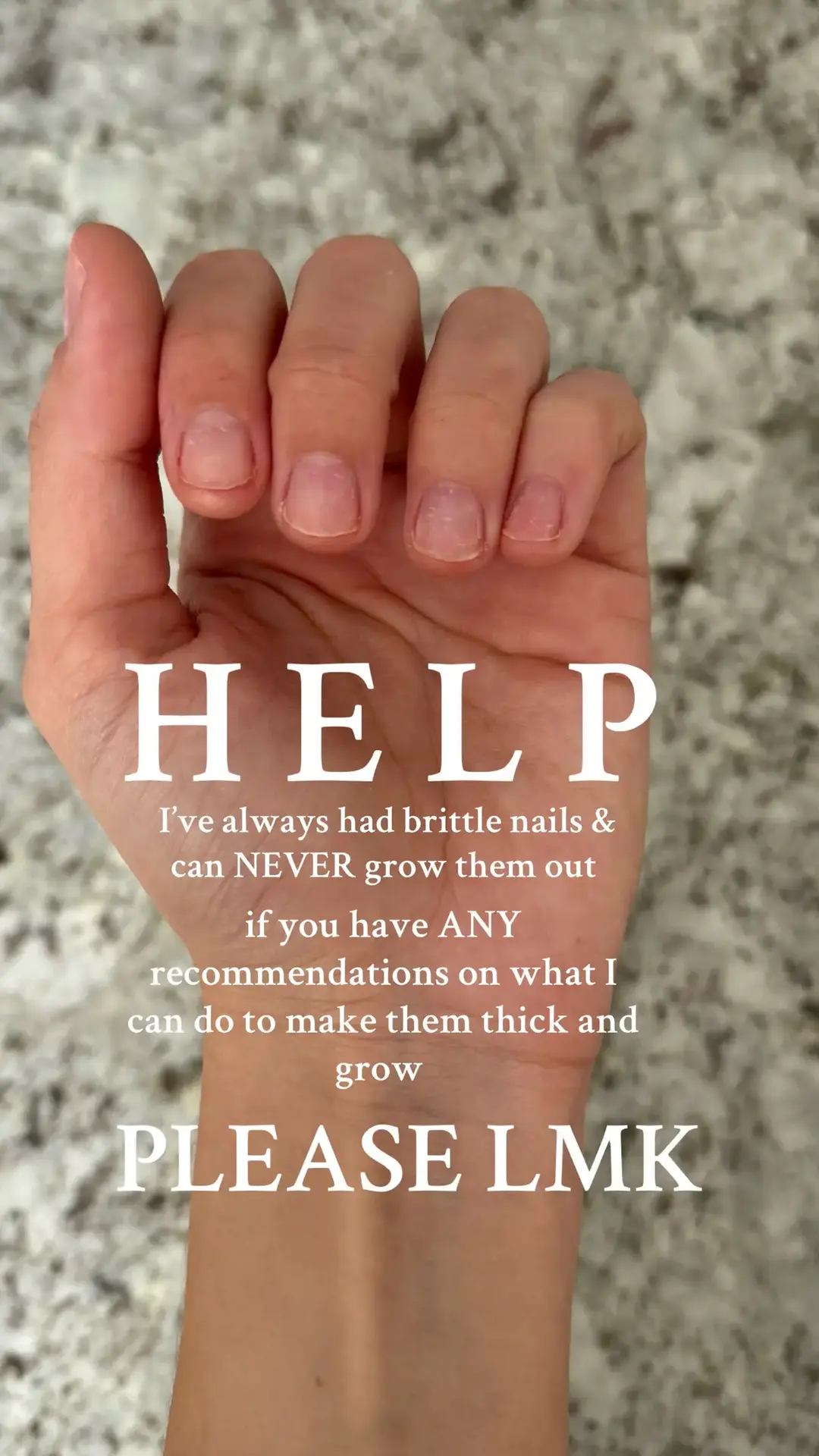 PLEASE HELP A GIRL OUT #nail #nailhealth #foryoupage 