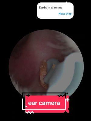 #creatorsearchinsights #ear #earwax #earcleaning #earcamera #earwaxremoval #earwaxremover  #tiktokshopyearendsale #newyearnewaura #TikTokShop 