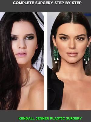 How Kendall Jenner did Plastic surgery: Plastic surgery' #KendallJennerPlasticSurgery #CelebrityPlasticSurgery #CosmeticEnhancements #BeautyTransformation #SurgicalGlowUp #JawlineGoals #EnhancedBeauty #PlasticSurgeryJourney #KendallJennerInspired #CosmeticProcedure @Kendall Jenner 