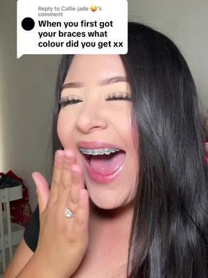 Replying to @Callie jade 😜 THE MOMENT I GOT MY BRACES 💕🫶🏼#bracesoff #bracescolors #bracestips #bracesguide #bracesideas 