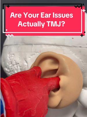 Do you experience ear pain, ear aches, ear ringing, pressure, fullness in the ear? Have you been to the ENT, audiologist, neurologist… And all the doctor say nothing’s wrong?  Well, this all increases the likelihood that it’s a TMJ disorder.  You see the TMJ butts right up against the ear canal and can cause many ear symptoms. If you also experience any type of jaw discomfort, even neck pain  or headaches, it could increase the likelihood this is a jaw issue.  In this video, I discuss a quick assessment you can complete to identify if this is a temporomandibular disorder. The final question asked if any of the following make the symptoms BETTER or WORSE. What that means is that if any of the movements describe impact in any way to make you feel better, or to make you feel worse that still means it can be a TMJ issue because movement of the JAW impacts your symptoms, and that’s the bottom line.  #tinnitus #ent #earache  #tmj #tmd #tmjdisorder #dentist #denstistry #neurologist