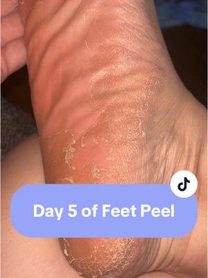 Satisfying 😅 #newyearnewaura #feetpeel #feetmask #smoothfeet #pedicure #smoothfeet #footcallus #footcare #footmask #SelfCare 