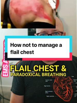 #onthisday How not to manage a flail chest. #fyp #Paramedictok #paramedicsoftiktok #medicsoftiktok #medictok #emtsoftiktok #emstok #Paramedic #paramedics #firstresponders #firstrespondertok #firstrespondersoftiktok #firefightertok #firefightersoftiktok #paramedicstudent #emtstudent #emstiktok #emergencymedicine #ambulance #ambulancetok #911 #paramedicstudentsoftiktok #emtstudent #emtstudents #emtstudentsoftiktok  #nursetok #nursesoftiktok #nurse #nurse #rntok #rnsoftiktok  #CriticalCare #CriticalCareParamedic #CriticalCareParamedicsoftiktok #CriticalCareTok #CriticalCareofTikTok #FlightParamedicsoftiktok #FlightParamedictok #FPC #CCPC  #Firemen #FiremenofTikTok #firemanTok #FireMedic #FireMedics #FireMedicsofTikTok  #cardiacarrest #OHCA #resuscitation #FOAM #FOAMED #FOAMEMS #12lead #12leadecg #12leadekg #Cardiology 