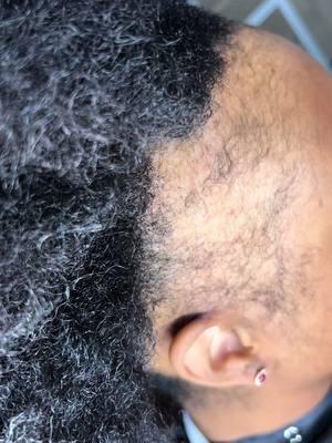 Despite experiencing hair loss along the edges, I am confident in my ability to create a beautiful and natural-looking hairstyle without the need for a frontal piece, ensuring both style and comfort. #alopeciabraider #boho#hairlosshelp #viralvideo #gwinnettbraider #atlbraider #edges #edgestutorial #edgesonfleek #atlantahairstylist #atlbraider #atlantahair #hairloss #knotlessbraids #boxbraids #hairstyle 