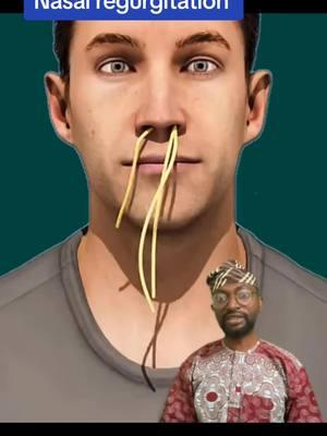 Nasal regurgitation (apọjẹ imu) #yoruba #yorubalanguage #nollywood #science #yorubanimi #Yorubaland #yorubamovies #yorubatiktok #yorubacomedy #yorubareligion #yorubawedding #yorubademon #lagos #lagostiktok #lagosnigeria #lagosta #lagoslife #ibadan #ibadanpeople #ibadantiktok🔥 #ilorin #ilorinpeople #ilorintiktoker #oyo #oyostate  #ekiti #ekitiktok #ekititrends #ondo #ondostate #abekuta #ogunstate #yorubagirl #yorubaboy #scienceinyoruba #yorubaweddings 