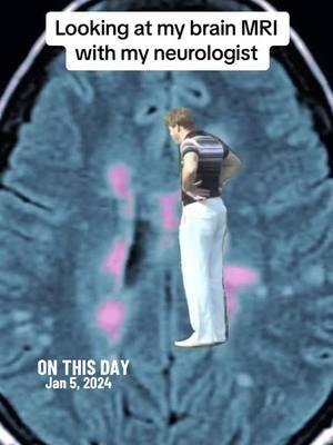 #onthisday #multiplesclerosis #mswarrior #multiplesclerosiswarrior #thisisms #mstok #msawareness #mslife #multiplesclerosischeck #multiplesclerosistiktok #mssucks #mssucksbutimstillfabulous #chronicallybadass #autoimmunedisease #rrms #spms #ppms 