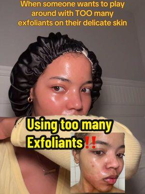 Don’t over do it with the exfoliants, trust me on this one! One in your routine is enough or cycle out exfoliants in your routine. Using too many exfoliants at one point destroyed my skin barrier. Follow for more skincare advice 🫶🏽 #acne #pimples #breakouts #hyperpigmentation #chemicalburn #squidgame 