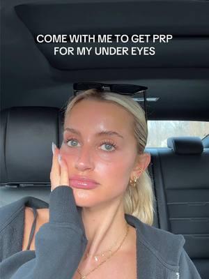 been a bit MIA this weekend 🖤 come with me to get PRP for my under eyes - I will be sharing the whole journey and I am excited for the end result! If you feel like this is something you are a candidate for and want, I would definitely book a consult with @ABELLA AESTHETICS MEDICAL SPA ☺️ they truly are amazing #prpundereye #prpundereyetreatment #cosmetictreatment 