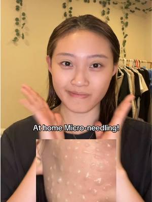 Trying out the Spicule pore tightening masks!! @Mediheal Us @BAZZAAL  #mediheal #microneedling #spiculemask #athomefacial #poreperfection #collagenfacemask #glowgamechanger #glasskin #makeupready #skinprep