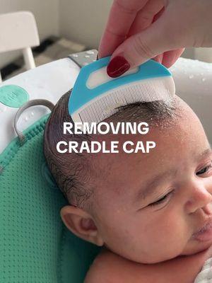 Would GLADLY peel them off one by one with my fingers tbh #momtok #newborn #newbornbaby #cradlecap #satisfying #pimplepopping #babygirl 