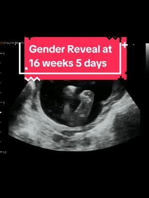 What do you think this baby is? #heybabymobile #rochesternyultrasound #2dultrasound #pregnancy #girlorboy #boyorgirl #babylegs #genderreveal #genderrevealultrasound #16weeks5dayspregnant www.HeyBabyMobile.com 