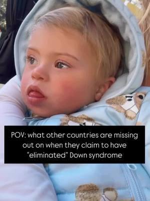 Some countries, such as Iceland, Denmark, and France, have drawn international attention for their claims of nearly “eliminating” Down syndrome. However, this term is deeply misleading. Down syndrome has not been eradicated—what these countries have accomplished is a significant reduction in the number of babies born with the condition, primarily through high termination rates following a prenatal diagnosis. Efforts to “eliminate” Down syndrome don’t remove a condition; they erase the opportunity to welcome individuals who bring immense love, joy, and diversity into the world. A truly compassionate community is not measured by its ability to eliminate differences but by its willingness to embrace, celebrate and share life with 🤍 #UnconditionalLove #downsyndromeawareness #BlessingsInDisguise #nothingdownaboutit