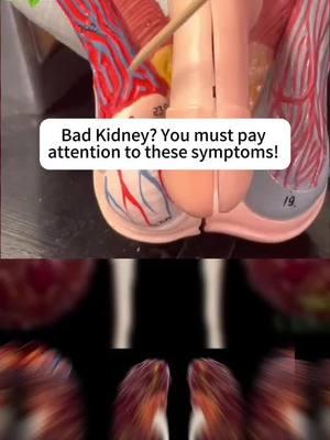 #kidneyfailure #kidneystone #Recipe #health #kidneycancer #kidney #fyp 