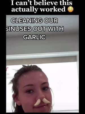 Have you tried this? 😳 #sinus #sinusitis #sinusrelief  Placing garlic in the nose for sinus drainage is a popular but risky home remedy. The idea is that garlic’s active compound, allicin, irritates the nasal lining, stimulating mucus production and clearing blockages. However, this method poses risks like nasal irritation, burns, tissue damage, or accidentally lodging the garlic too deep, causing an obstruction. Instead, safer alternatives such as saline nasal rinses, steam inhalation with essential oils, and staying hydrated are more effective for relieving sinus congestion. While some claim garlic works, medical professionals generally advise against it due to these potential dangers. (videos: hwannah5 + siuwupeepoo)