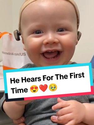 Deaf babies getting their hearing aids for the first time 🥹❤️ #baby #cutebaby #babiesoftiktok #babytok #babytiktok #kid #kidsoftiktok #deaf #hearingaids #emotional #wholesome #touching #tearsofjoy #happytears #moments #fyp 