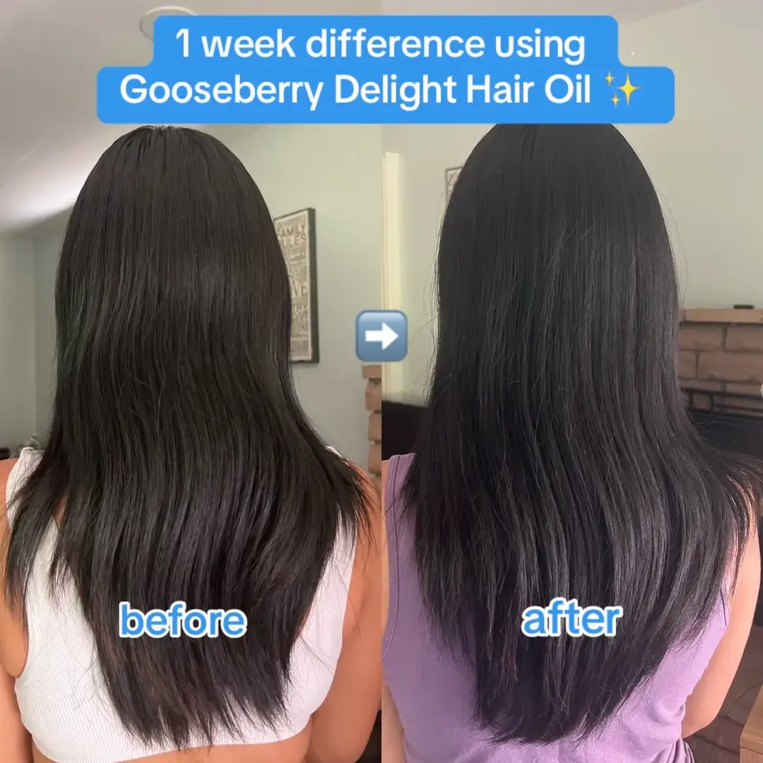 We are obsessed with our 5x award-winning Gooseberry Delight Hair Oil, and we love seeing you are too🥹💗 With a nourishing formula packed with: Amla Extract, Castor Oil, Coconut Oil, Kalonji Oil, Orange Peel Oil ✨🫧  #squigsbeauty #hairbeforeafter #hairgrowthjourney #hairgrowthtips #hairoilforhairgrowth #hairoilingbenefits #gooseberrydelighthairoil #creatorsearchinsights 