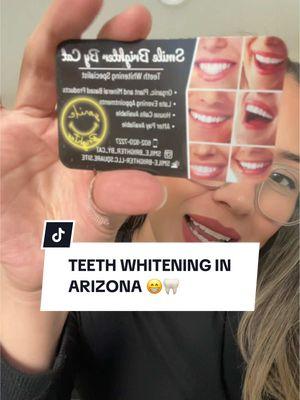 @Cat is her TikTok also check her out 🫶🏻 #teethwhitening #pearlywhites #SmallBusiness #arizona #housecalls 