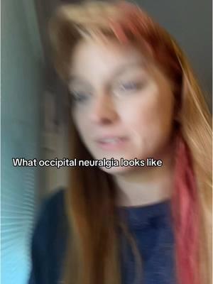 I was snapping my friend about my bangs looking nice and 90s  when the ON hit and it’s always funny to watch these back 😭🥹 #occipitalneuralgia  #chronicpain #chiarimalformation 