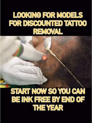 The hunt is not over yet! Start your tattoo removal journey with us now and be ink free by end of the year 🥹😮‍💨😍 @zapatatdmv We are looking for models from now till end of the month for discounted tattoo removal. Call 703-248-0909 or book Zapatat.net . . #herndonva #tattooremoval #lasertattooremoval #sterlingva #arlingtonva #dmv#tattoolifecommunity #newyearsresolution  .