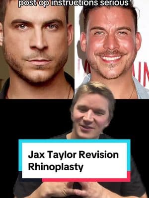 This is a great example on why it’s important to follow your surgeons instructions after rhinoplasty! #revisionrhinoplasty #jaxtaylor #bostondoctor  