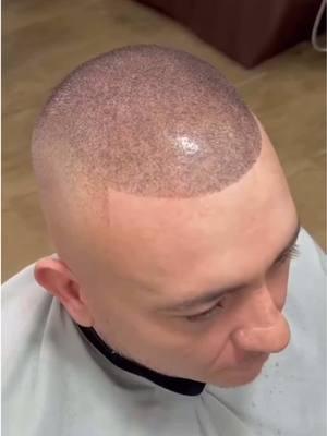 From Bald to Bold in Seconds! 🧢❌➡️✅ Fellas, let’s be real losing your hair feels like a personal attack from genetics🥹 You wake up one day, look in the mirror 🪞 & BOOM… your hairline took an early retirement🥲 But before you start googling “best hats to hide baldness” or “how to accept being hairless,” let us put you on to Hair Illusion, the realest hair transformation you’ll ever see 💎 This ain’t a hat 🧢 This ain’t a wig 💆🏽‍♂️ This ain’t some sketchy potion promising magic in 6 months😂 This is instant results, no waiting, no surgery, no regrets💯 100% natural real hair fibers that blend seamlessly with your scalp, giving you back that full, thick look in seconds 💨 & before you ask, YES, it’s sweat-proof 😅 rain-resistant ☔️ & won’t expose you mid-date when properly applied using our water 💧 resistant spray!  This right here? This is confidence in a bottle. This is reclaiming your look, your swag, & your energy 👑 Because let’s be honest when you look good, you FEEL good. & when you feel good, you move different 😌💯💎 Hair loss? Handled ⚡️ Confidence? Restored 😎 The hat collection? Retired 🥰 Change the way you see yourself today🚀 #HairIllusion #HairTransformation #HairStylist #MensGrooming #HairLossSolution #Confidence #SelfCareForMen #balding #Scalp #HairGame #RealHairFibers #BaldingFix #HairGoals #MensStyle #InstantResults #ForeverYoung #Barber #HairMagic #HairLoss #GlowUp 