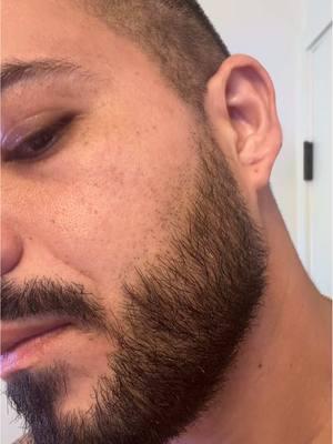 Con este  #serum HAIR growth de sefudun para el crecimiento transformé mi #barba debido a su fórmula de minoxidil + biotin #serums #haircare #menhairgrowth #menhair #serum #barba #beardgrowth #beard #hairgrowth #minoxidil #beardstyle #men #beardtok #beardmen #haircareroutine 