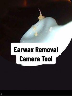 Possibly the COOLEST thing TikTok has ever made me buy!! I love cleaning my ears in general because it feels good but getting to see the inner eat and wax come out… INCREDIBLE!! #earwax #earwaxremoval #earwaxremovaltool #hygeine #GRWM #momthings #bathroommusthave #Tiktokjumpstartsale #newyearnewaura 