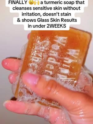 BestSeller for Clear+ Glowing Skin in under 2weeks WITHOUT staining, skin irritation and is gentle for twice daily use 🧡#turmericsoap #turmericsoapbar #turmericsoapsoapfordarkspots #turmericskincare #turmericbenefits #turmericsoapbars #helloclearskinsoap #helloclearskinsoapbar #hyperpigmentationtreatment #whippedwonderlandskincare #naturalskincarebusiness #smallskincarebusiness #fyp #foryoupage #creatorsearchinsights #organicskincare🌱 