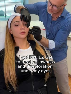 PRF EZ Gel uses your own 🩸 to create a temporary filler. I like to use it under my eyes to correct hollowness. I get it done with @doctorhorvath at Horvath Aesthetics in King Of Prussia PA 📍 #PRF #PRFEZGel #filleralternative #biohacking #antiaging #skincare #creatorsearchinsights 