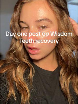 Day one after my wisdom teeth surgery! I am feeling better this evening #wisdometeethaftermath #wisdomteeth #wisdomteethrecovery 