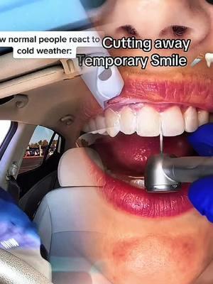 #dentalveneers#asmrteeth#breakingteeth#veneers#oddlysatisfyin#dentalveneers#naturalveneers#deepcleaning#teethcleaning#flossing