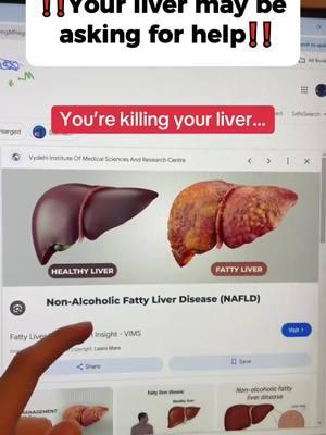 It's time to detox your liver!#HarvardApparatus #LiverDetox #LiverHealth #HealthyLiving #NaturalSupplements #healthregen #liverguard #tiktokshopping #supplements #liver #healthbenefits #healthy #regen #liverhealth #fyp
