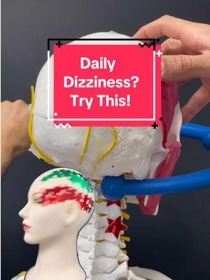 Do you experience daily dizziness, and you have stiffness or pain in your neck? Have you also been to all sorts of doctors and they tell you the tests are negative and you don’t have a vestibular issue?  Or maybe you do have a vestibular issue that should’ve went away ? Well, there are three parts to the vestibular system, which includes vision, inner ear and proprioception. Proprioception means there are receptors in your tissues that tell you where your body part is moving in space. When this information is erroneous, due to restrictions in conversations, it sends miss information to the brain causes dizziness.  Very commonly, we find that the neck is a large part of dizziness issues, especially with all the traditional vestibular treatments or tests by your ENT neurologist and other doctors come back negative. Typically this feels like persistent, ongoing discomfort versus big, dizzy events, that the debilitate your day. Instead, it’s just an ongoing discomfort, that impacts quality of life.  In this video, I show a simple strategy to release upper cervical restrictions that can lead to cervicogenic dizziness. So try out it out and… #dizziness #vertigo #vestibular #vestibularmigraine #dizzy #headacherelief #migrainerelief #tmj #tmjdisorder #ent #neurologist