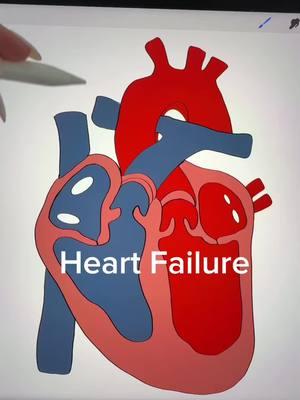 🫀Heart Failure. Right and Left Side and how to treat CHF. #chf #heartfailure #nursesoftiktok #futurenurse #nursetok #nursingschool #nursingstudents #bsn #nclex #nursingnotes ##nursingmajor #newnurse #rn#CapCut 