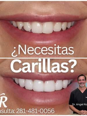 ¿Necesitas Carillas? Agenda tu cita con el Dr. Ángel Román. Especialista en:  🔹 Odontología estética y restaurativa  🔹 Ortodoncia  🔹 Cirugía maxilofacial  🔹 Diseño de sonrisa  🔹 Periodoncia  🔹 Implantes dentales y valoración  @drangelroman   Más que dentistas, somos arquitectos de sonrisas, Clínica dental en Houston. Consulta: 281-481-0056 info: www.mypearlanddentist.com 10950 Resource Pkwy c, Houston, TX 77089    #DrAngelRoman#HoustonDentalCare #SaludDental #ResourceParkwayDental #DentistaEnHouston  #CentroMedicoDental  #planbtelevision #hounews 