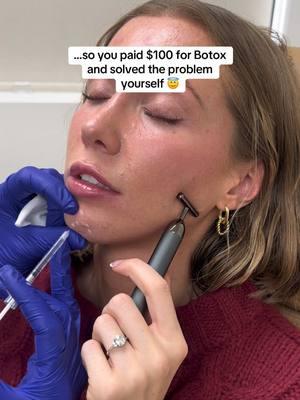 I’ve worked with various doctors for YEARS to try and get rid of my chin wrinkles… who knew all it took was a couple units of Botox to get rid of a literal lifelong insecurity 🥹 I went to Emily at True Beauty Forever in Kaysville and she did an amazing job! #jawsurgery #botox #botoxnatural #dysport 