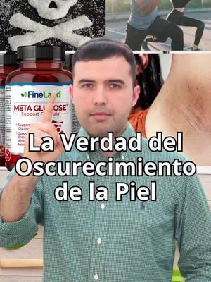 ¿Sabías que el oscurecimiento de la piel puede ser un signo de algo más? Descubre las causas más comunes de este problema, desde la exposición al sol hasta desequilibrios hormonales, y aprende soluciones naturales y efectivas para recuperar una piel radiante. ¡No te lo pierdas!
 
 #oscurecimientodepiel #hiperpigmentacion #manchasenlapiel #pieloscura #tonodepiel #melanina #pielsana #cuidadodelapiel #belleza #salud #skinhyperpigmentation #darkspots #skintone #melanin #skintreatment #skincare #beauty #healthy 