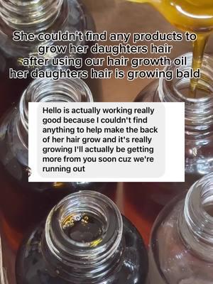 She couldn't find any products to help grow her daughters hair. Using the hair growth oil she is starting to see growth. Shop noellastresses.com for our hair growth oil   #hairgrowth #hairlossremedy #hairloss #hairlosssolutions #naturalhairtiktok #naturalhair #naturalhaircare #blackowned #blackownedbusiness #hairgrowthoil #blackownedhaircare  #cookingwithmula #cookingwithkya #blackownedhaircareproducts #haircareproducts #hairgrowthoils #viralgrowthoil #4chairgrowth #haircare #hairgrowth #TikTokShop #trending #digitalmarketing #digitalproducts #contentcreator #digitalproductsforbeginners #boholnotlessbraids #bohobraids #knotlessbraids #knotlessbohobraids #summerbraids #naturalhairproducts #blackownedhaircareproducts 