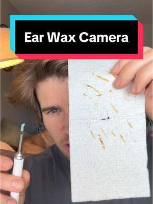 Ear Wax Removal #earwax #earwaxcamera 