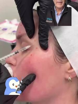 AAFE’s Botox tips and tricks! Volume UP to hear a tip for crows feet injections‼️😆 Learn how to do this and much more at facialesthetics.org  Learn it. Live it. Give it!  Get AAFE Certification trained today! ° °  ° #AAFE #aafecertified #esthetics #facialesthetics #botox #filler #education  