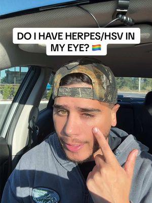 Replying to @user573839473 I do not have herpes or HSV in my eye. It’s extremely ignorant how often people assume a gay person feeling or looking unwell has an STD or STI. It’s 2025 this kind of thinking needs to stop. #gaytiktok #gaytok🏳️‍🌈 #lgbtq #lgbt #pinkeye #herpes #HSV #gayboy #gaycommunity🏳️‍🌈 #std #lgbtqtiktok 