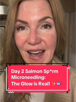 Day 2: The Glow is Real! ✨🐟 It’s Day 2 after my Salmon Sperm Microneedling, and my skin is already showing signs of that legendary K-Beauty glow! 🌟 Here’s what I’m noticing: 💧 Hydration is improved 🌿 Skin feels smoother and calmer ✨ Fine lines are already looking softer This treatment is a must-try for menopause skincare!  #SalmonDNAMicroneedling #salmonspermmicroneedling #SkinRejuvenation #KBeautyTrends #MenopauseGlowUp #menopauseskin #dryskin #antiagingskincare #PlumpAndRadiant #GlassSkinGoals 