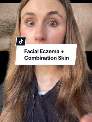 Facial eczema dermatitis and combination skin? Signs of seborrheic dermatitis on the face. #eczema #dermatitis #combinationskin #dermatologist #greenscreen #creatorsearchinsights 