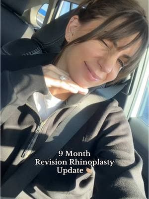 In case you’re currently in month 1 - I PROMISE the swelling will go down! But they’re not kidding when they say it takes over a year to see the results 🫠 I still have swelling in the tip and I swear it looks different every day #nosejob #revision #revisionrhinoplasty #nosejobcheck #rhinoplasty 