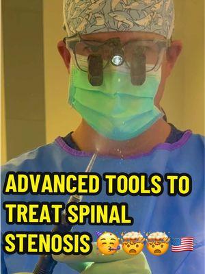 🚨 Ultrasonic Spine Surgery - Cutting edge techniques with advanced tools #spine #Dallas #hometown #family #stenosis #cervical #lumbar #telemed #expert #teacher