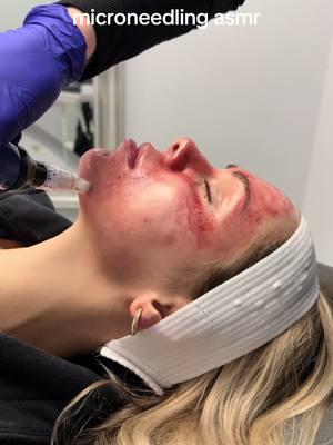 an addiction……. #asmr #avonohio #medspa #aestheticnursepractitioner #esthetician #facials #clevelandmedpsa #aestheticnurseinjector #medspatiktok 