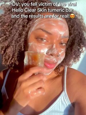 This soap is the BEST for Naturally Beightening & Clearing Skin!😍 #turmericsoap #turmericsoapbar #turmericsoapsoapfordarkspots #turmericsoapbars #turmericsoapforacne #turmericsoapforsensitiveskin #helloclearskinsoapbar #helloclearskinsoap #fyp #foryoupage #smallskincarebusiness #naturalskincarebusiness #organicskincare🌱 #whippedwonderlandskincare 