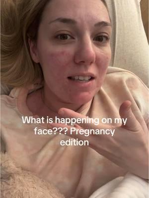 Help…? What is this… #pregnancysymptom #pregnancy #facerash 