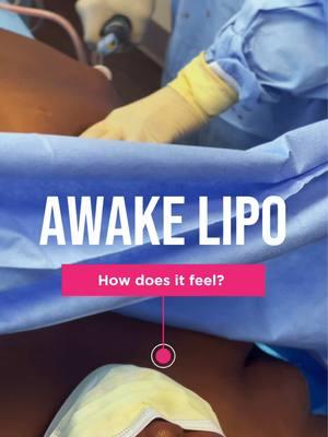 Curious about how awake liposuction feels? 🌟 Most patients describe it as surprisingly comfortable! With local anesthesia, you’ll feel gentle pressure and movement, but no pain—plus, you’re awake and in control the whole time. 💪 It’s a safe and empowering way to sculpt your body, with minimal downtime and maximum results. ✨ Ready to experience the difference?  Are you ready to take the next step? ➡️➡️➡️ Visit the link in our bio for more details or to schedule your consultation. Prefer texting? Reach out directly at 404-240-2804.   🌐 www.drlissa.com   #atlantaplasticsurgery #lipo360  #highbmi #plussize #fyp  #AwakeLipo #BodySculpting #Transformation #plussizeedition 