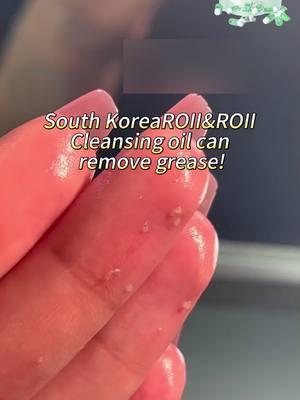 Are you still troubled by blackheads and whiteheads?😵‍💫😵‍💫😵‍💫#rollroll #southkorea🇰🇷 #cleaningoil 